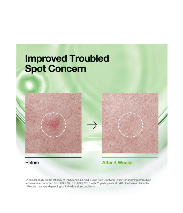 Anua Azelaic 3 Cica Skin Clarifying Toner Korean Skincare 250ml / 8.45 fl. oz.