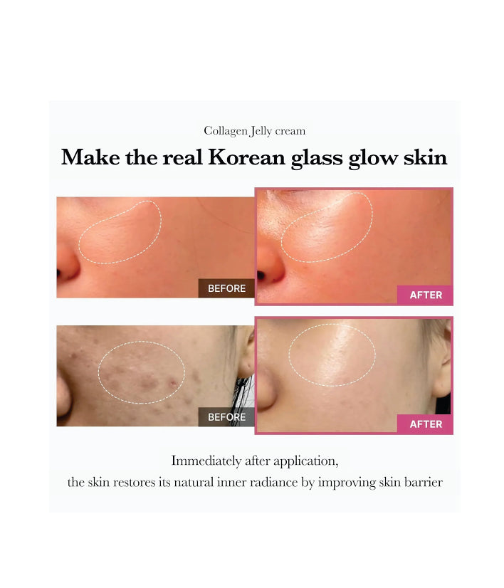 Medicube, Collagen Niacinamide Jelly Cream , Korean skincare (3.71 fl.oz.)