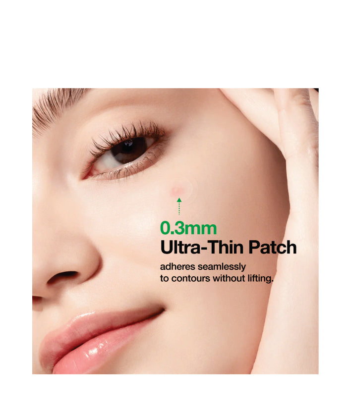 Anua Triple Acid Spot Care Microdart Patch Korean Skincare 12EA