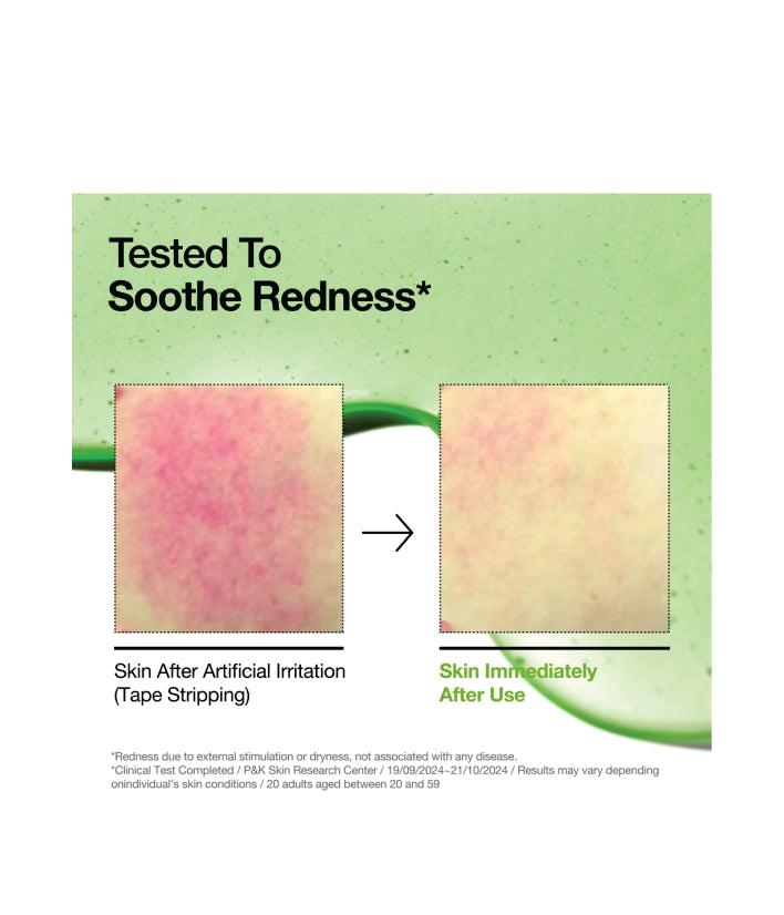 Anua Azelaic Acid 10 Hyaluron Redness Soothing Serum Korean Skincare 30ml / 1.01 fl. oz.