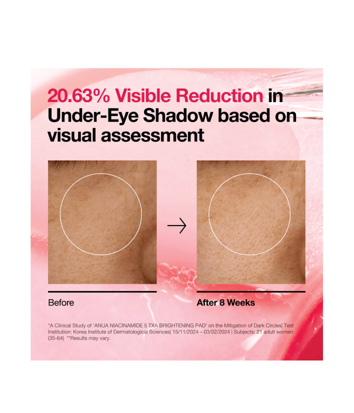 Anua Niacinamide 5 TXA Brightening Pad 70 Pads Korean Skincare 250ml / 7.10 fl. oz.