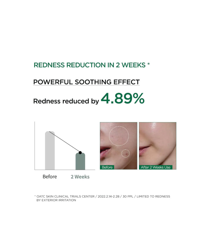 Anua Heartleaf 80% Moisture Soothing Ampoule Korean Skincare 30ml / 1.01 f;. oz.