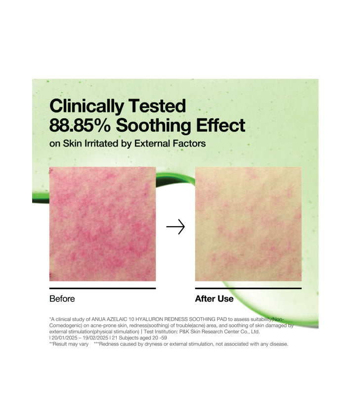 Anua Azelaic 10 Hyaluron Redness Soothing 90 Pads Korean Skincare 230ml / 7.77 fl. oz.