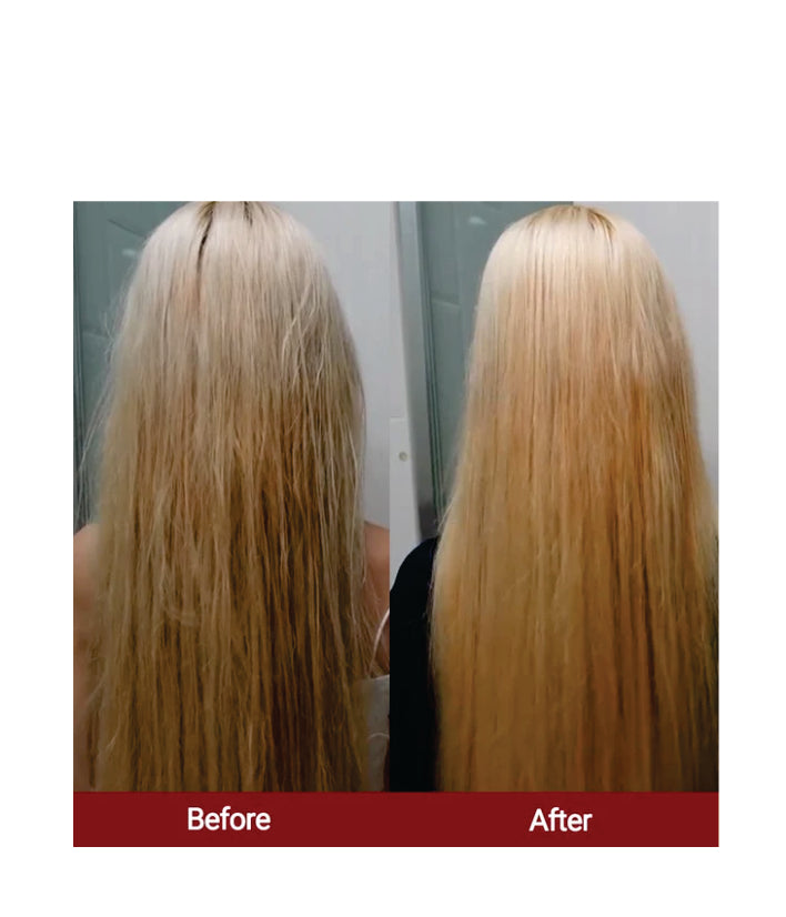 Medicube Soyxidil 2in1 Treatment Korean skincare 265ml 18.96 fl. oz.