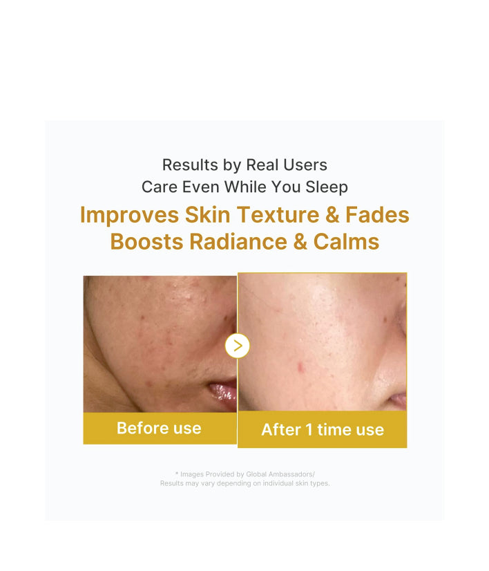 Medicube Kojic Acid Turmeric Overnight Wrapping Mask korean skincare 75ml / 2.53 fl. oz.