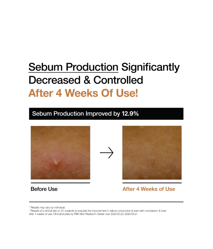 Anua Rice 70 Glow Milky Toner Korean Skincare 250ml / 8.45 fl. oz.