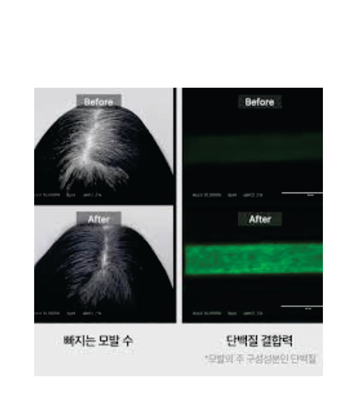 Medicube Soyxidil 2in1 Treatment Korean skincare 265ml 18.96 fl. oz.