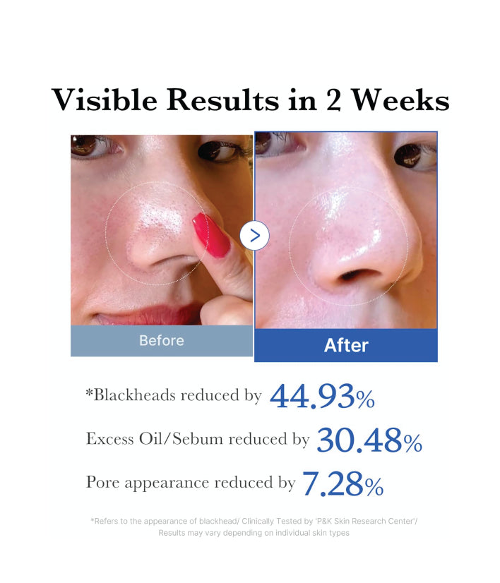 Medicube Zero Pore Pad 2.0 Korean skincare 155g / 5.46 oz. (70 Pads)