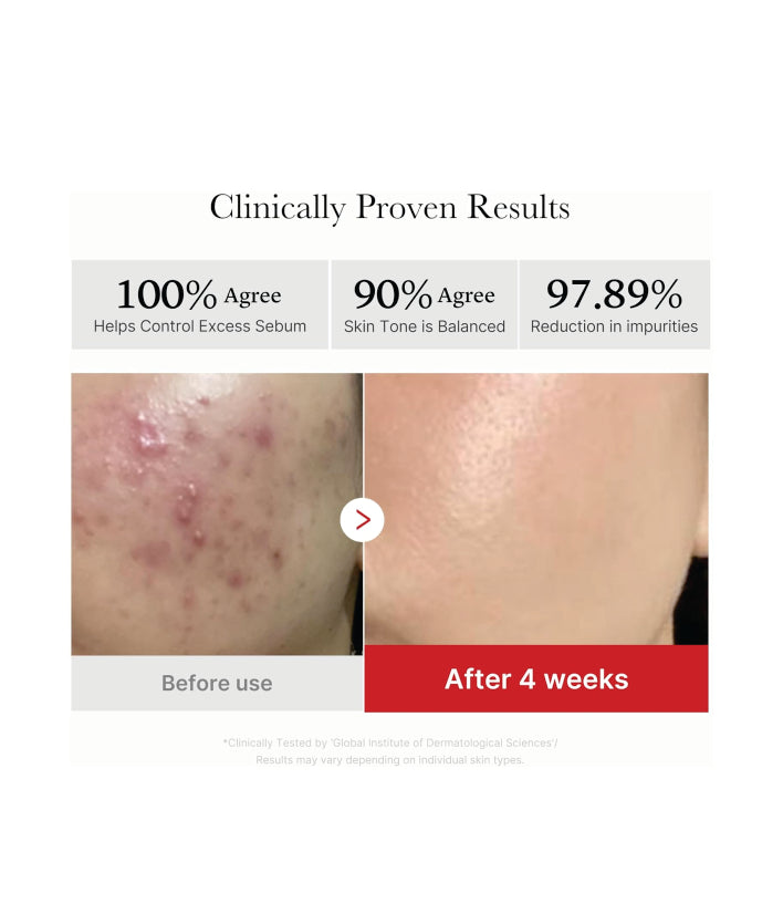 Medicube, Red Succinic Acid Panthenol Peeling Pad Korean skincare 155g | 5.46 oz. (70 Pads)